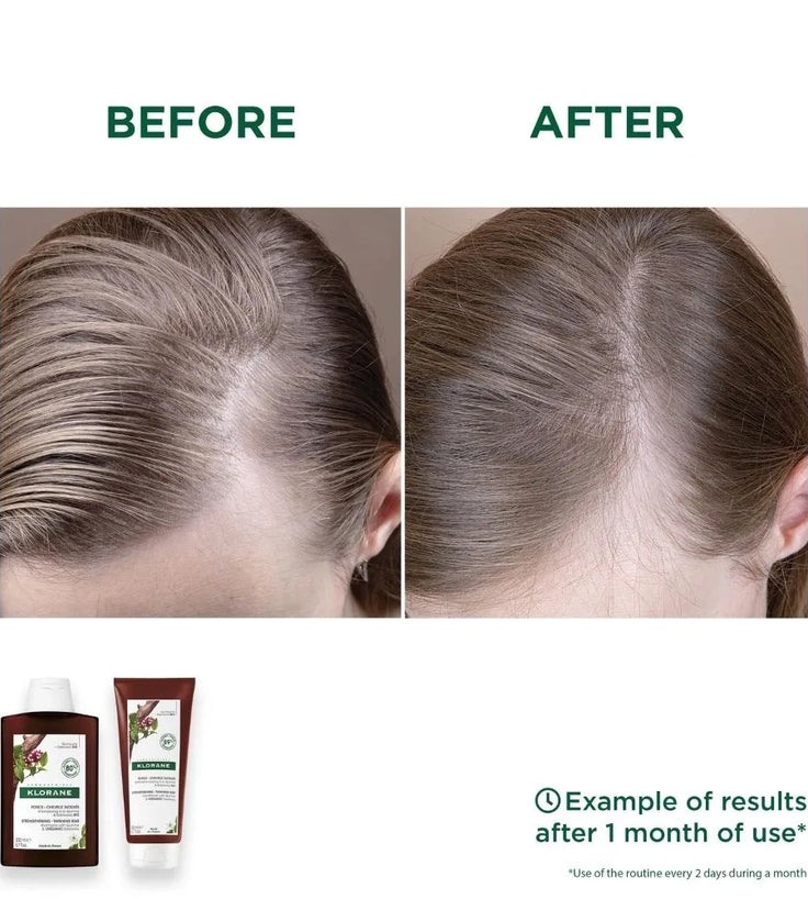 Klorane anti-haaruitval shampoo + conditioner