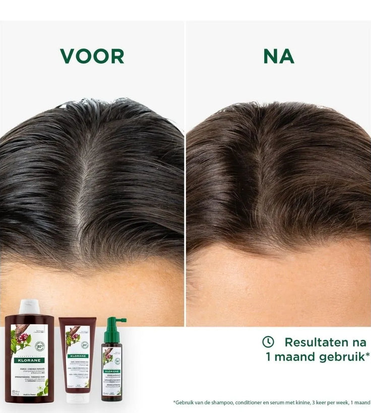 Klorane anti-haaruitval behandeling