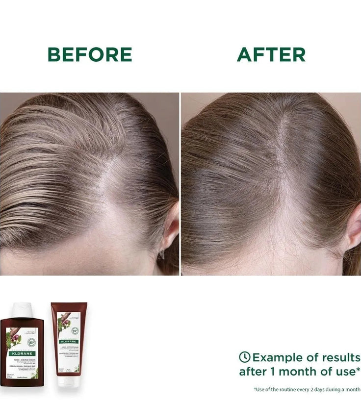 Klorane anti-haaruitval shampoo Kinine/Edelweiss (200 ml)