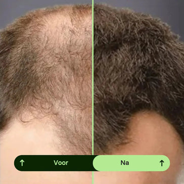 Toppik hair thickener kleurenspray Toppik hair thickener kleurenspray