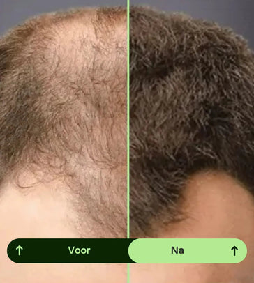 Toppik hair thickener kleurenspray Toppik hair thickener kleurenspray