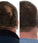 Foligain lotion man (10% Trioxidil)