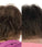 Foligain haargroei behandeling (vrouw)