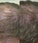 Neofollics shampoo 3-pack (3x250 ml)