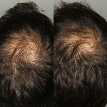 Viviscal hair growth supplement voor mannen (3 mnd) Viviscal hair growth supplement voor mannen (3 mnd)