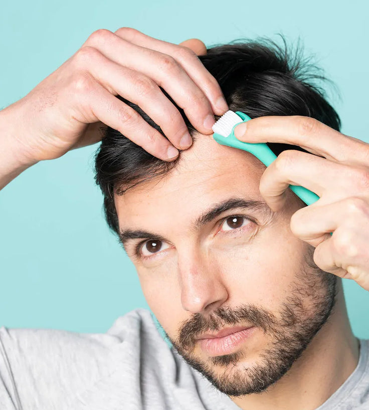 Neofollics scalp roller (0.3 mm)