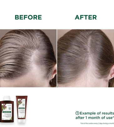 Klorane anti-haaruitval shampoo + conditioner
