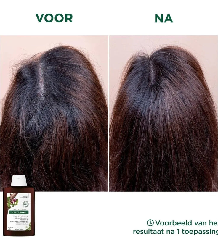 Klorane anti-haaruitval shampoo Kinine/Edelweiss (400 ml)
