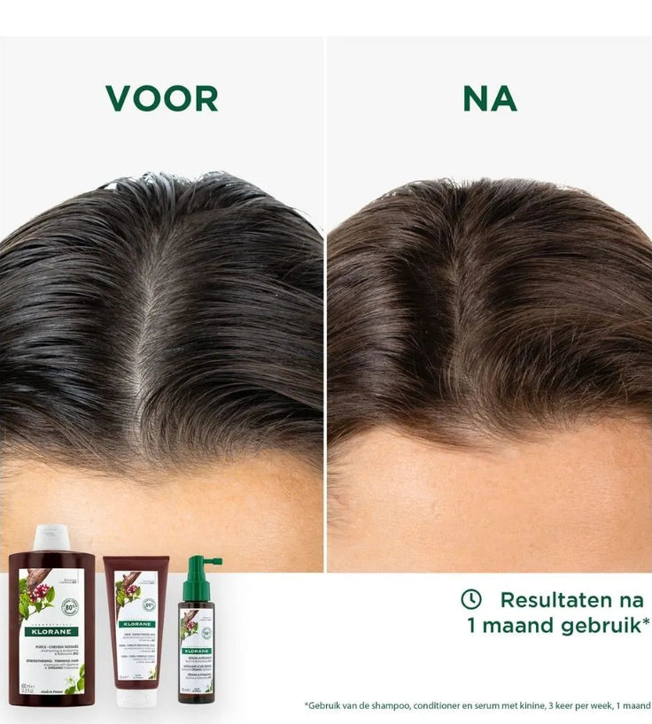 Klorane anti-haaruitval shampoo Kinine/Edelweiss (400 ml)