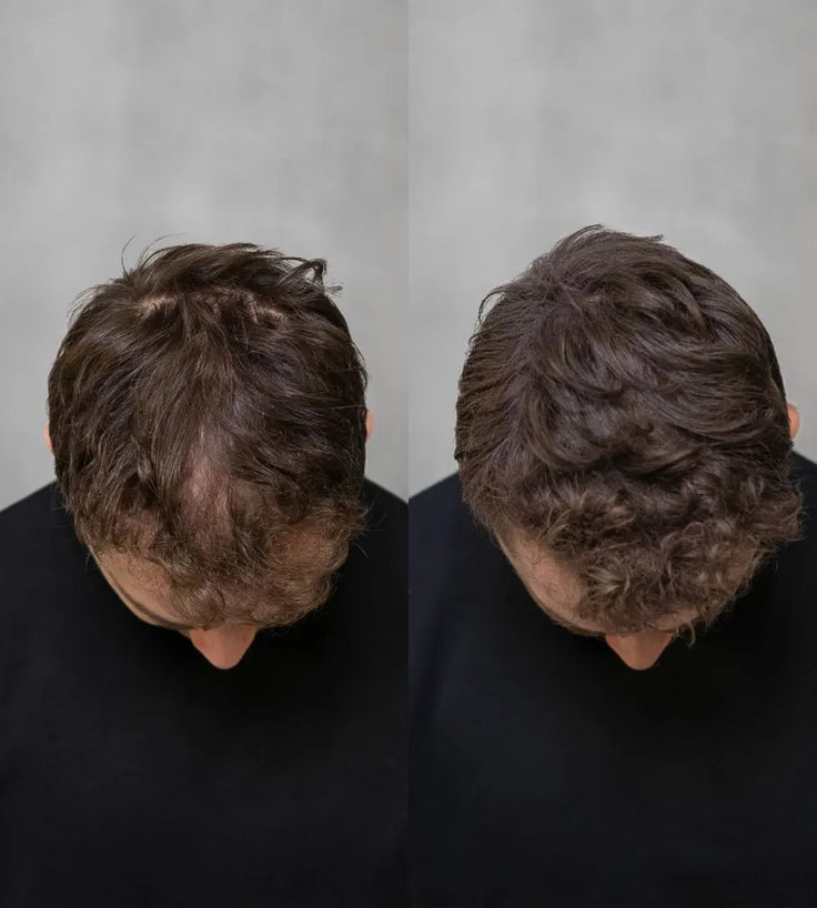 3x Keratain haarvezels + gratis Keratain pommade - Medium bruin (25 gr)