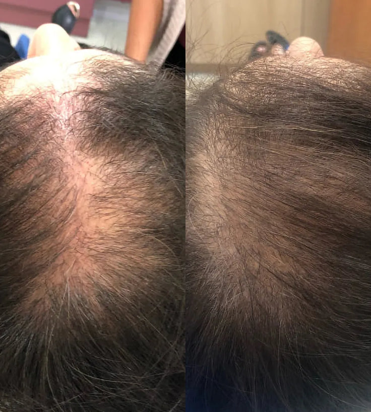 Spectral Women's Hair Density Serum (CSF)