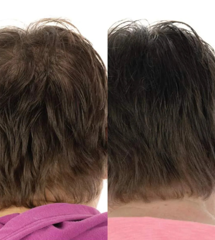 Foligain lotion vrouw (10% Trioxidil)