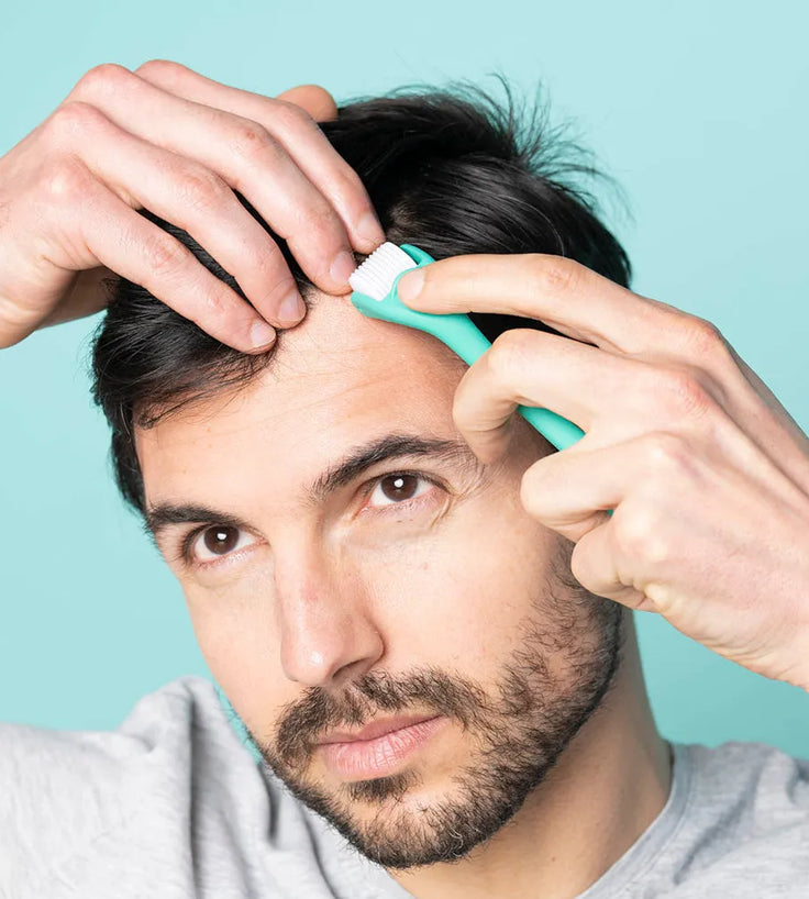 Neofollics Scalp Roller (0,3 mm) dermaroller