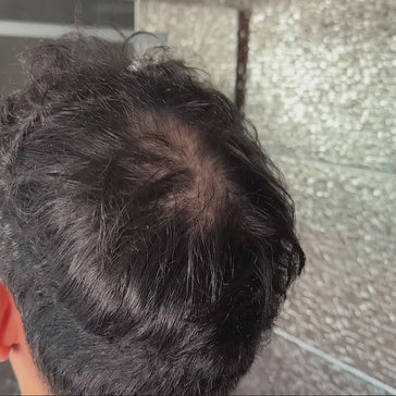 3x Keratain haarvezels + gratis Keratain pommade - De Haargroeispecialist