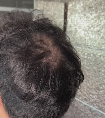 3x Keratain haarvezels + gratis Keratain pommade - De Haargroeispecialist