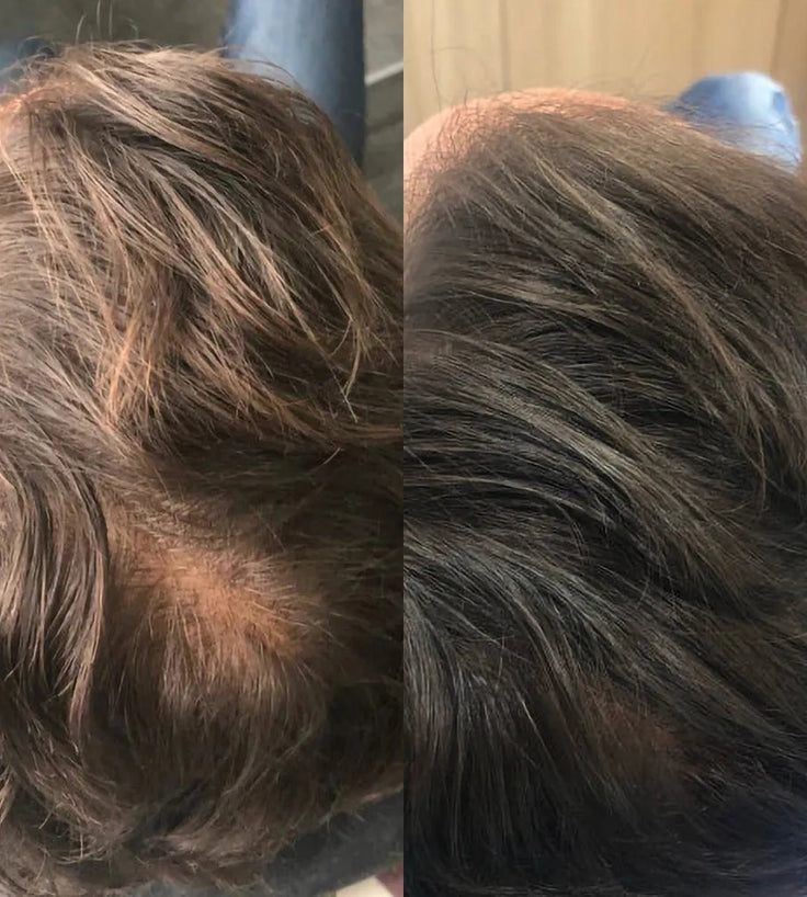 Revita shampoo + conditioner combinatiepakket (205 ml)