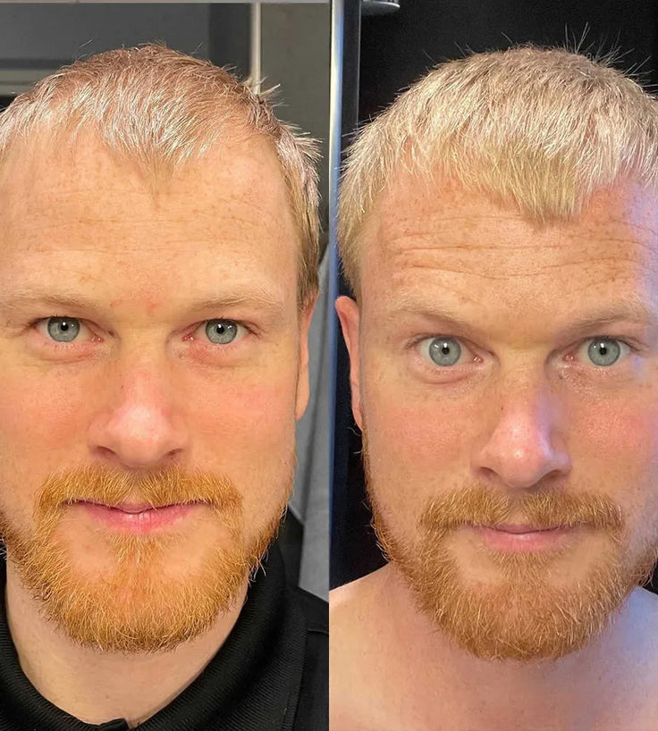 Scandinavian Biolabs Bio-Pilixin serum (man)
