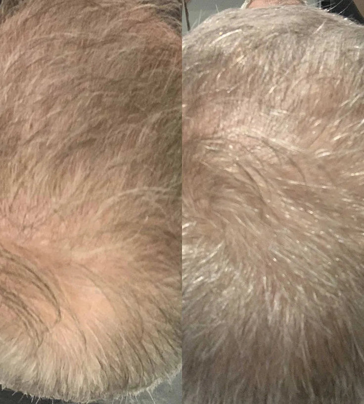 Scandinavian Biolabs shampoo + conditioner voor mannen combinatiepakket