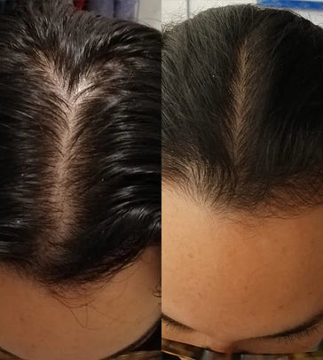 Scandinavian Biolabs shampoo voor vrouwen (250 ml)