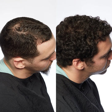 Theradome LH80 PRO laserhelm