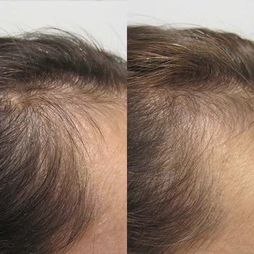 Viviscal hair growth supplement voor vrouwen (3 mnd)