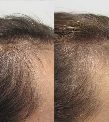 Viviscal hair growth supplement voor vrouwen (1 mnd)
