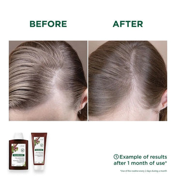 Klorane anti-hair loss shampoo + conditioner