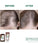 Klorane anti-hair loss shampoo Quinine/Edelweiss (200 ml)