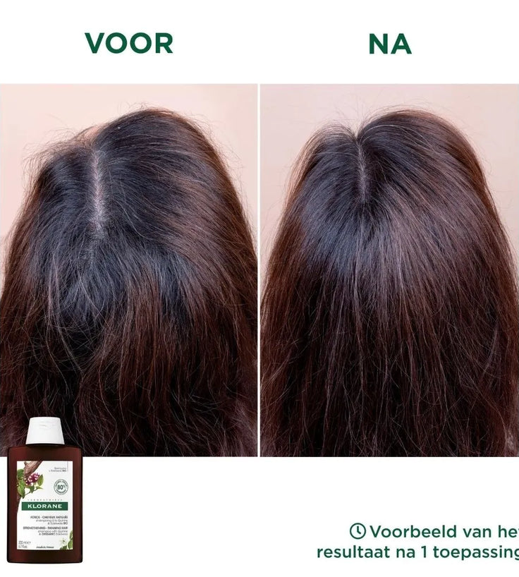 Klorane anti-hair loss shampoo Quinine/Edelweiss (400 ml)