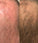 Panthrix hair growth activator (3-pack)